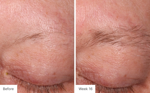 Close-up image of eyebrows showing fuller brows after 16 weeks of Lash Lush use